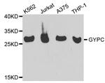 GYPC Antibody in Western Blot (WB)