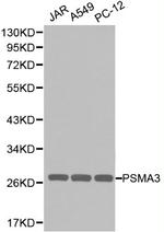 PSMA3 Antibody in Western Blot (WB)