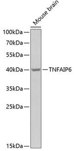 TNFAIP6 Antibody in Western Blot (WB)