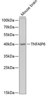 TNFAIP6 Polyclonal Antibody