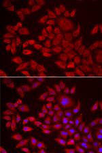 AGPAT2 Polyclonal Antibody