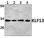 Acetyl-RFLAT-1 (Lys166) Polyclonal Antibody