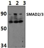 Acetyl-SMAD2/SMAD3 (Lys19) Polyclonal Antibody