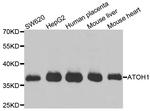 ATOH1 Polyclonal Antibody