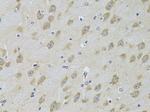 GRK3 Polyclonal Antibody