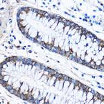 CAPZA2 Polyclonal Antibody