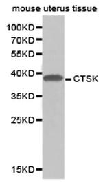 Cathepsin K Polyclonal Antibody