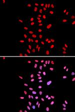 DKC1 Polyclonal Antibody