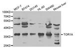 Torsin 1A Antibody in Western Blot (WB)