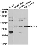 XPB Polyclonal Antibody