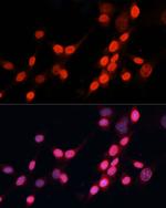 XPG Polyclonal Antibody