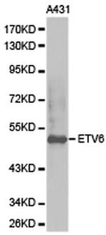 ETV6 Polyclonal Antibody