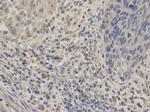 GABRA2 Polyclonal Antibody