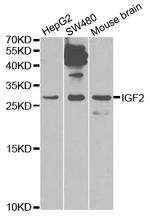 IGF2 Antibody in Western Blot (WB)