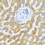 TECK Antibody in Immunohistochemistry (Paraffin) (IHC (P))