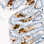 TECK Antibody in Immunohistochemistry (Paraffin) (IHC (P))