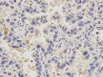 PDE1B Polyclonal Antibody