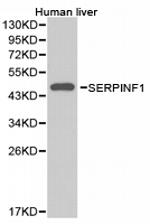 PEDF Antibody in Western Blot (WB)