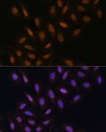 POLH Antibody in Immunocytochemistry (ICC/IF)