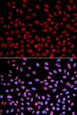 POLH Antibody in Immunocytochemistry (ICC/IF)