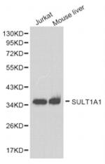 SULT1A1 Polyclonal Antibody
