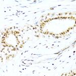 XRCC4 Polyclonal Antibody