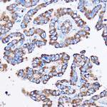 IL23R Antibody in Immunohistochemistry (Paraffin) (IHC (P))