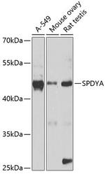 SPDYA Polyclonal Antibody