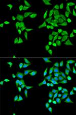 CES2 Polyclonal Antibody