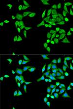 CES2 Antibody in Immunocytochemistry (ICC/IF)