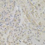 REG3A Polyclonal Antibody