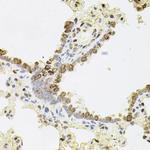 REG3A Antibody in Immunohistochemistry (Paraffin) (IHC (P))