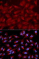RAPGEF3 Polyclonal Antibody