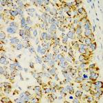 CHIA Polyclonal Antibody