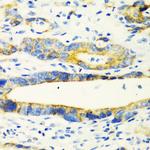 CHIA Antibody in Immunohistochemistry (Paraffin) (IHC (P))