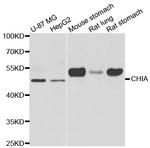 CHIA Antibody in Western Blot (WB)