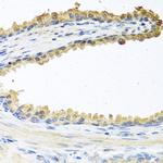 COCH Antibody in Immunohistochemistry (Paraffin) (IHC (P))