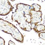 IFNAR2 Polyclonal Antibody