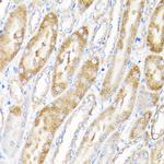 IKAP Antibody in Immunohistochemistry (Paraffin) (IHC (P))