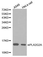 PLA2G2A Polyclonal Antibody