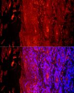 KRT9 Antibody in Immunocytochemistry (ICC/IF)