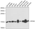 Calcineurin B Antibody in Western Blot (WB)