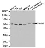 HRD1 Polyclonal Antibody