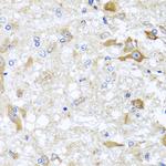 ABCB8 Antibody in Immunohistochemistry (Paraffin) (IHC (P))