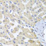 ABCB8 Polyclonal Antibody