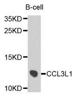 CCL3L1 Polyclonal Antibody