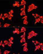 ARHGAP5 Polyclonal Antibody