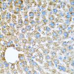 COX6A1 Polyclonal Antibody