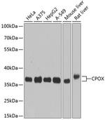 CPOX Polyclonal Antibody
