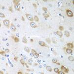 GFM1 Antibody in Immunohistochemistry (Paraffin) (IHC (P))